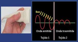 Física de Ultrasonidos